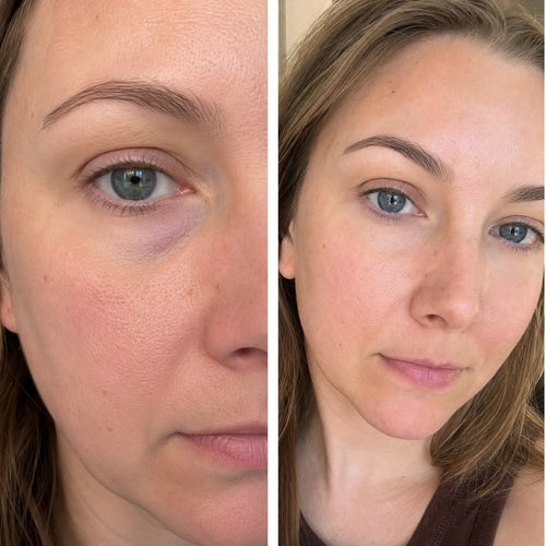 Ergebnis von Melanie R., 34